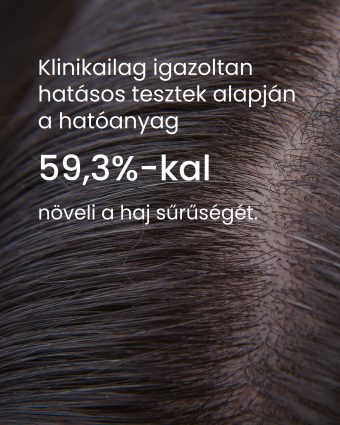 Natúr fejbőr tisztító radír  200ml